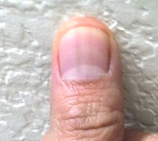 Nails and Health - WebMD