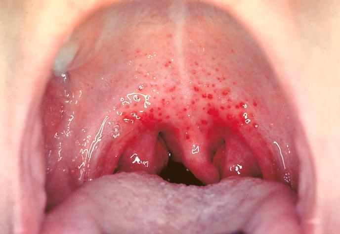 Red Spots On Mouth 72