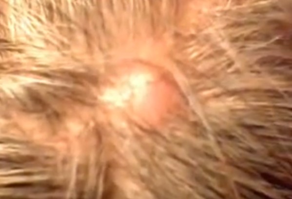 Scalp Conditions: 28 Causes, Photos, & Treatments