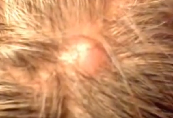 Scalp Problems | HealthLink BC