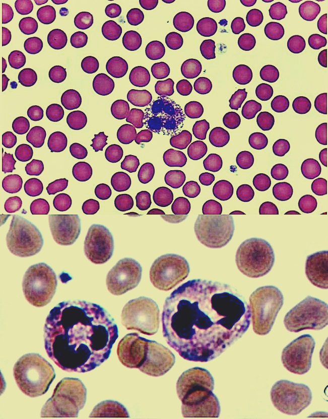 Neutrophils pictures