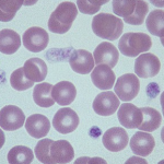 Low Platelet Count in Dogs
