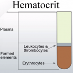 Hematocrit – Normal Levels, Low and High