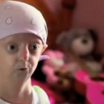 Progeria – Facts, Pictures, Symptoms, Causes, Treatment, Life Expectancy