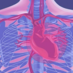 When does Angina Pectoris Occur?