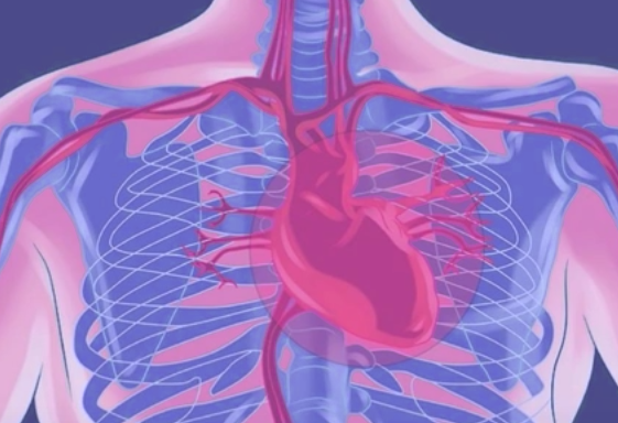 When does Angina Pectoris Occur?