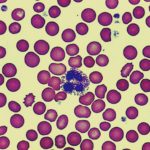 Neutrophils – What You Need to Know