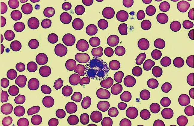 Neutrophils – What You Need to Know